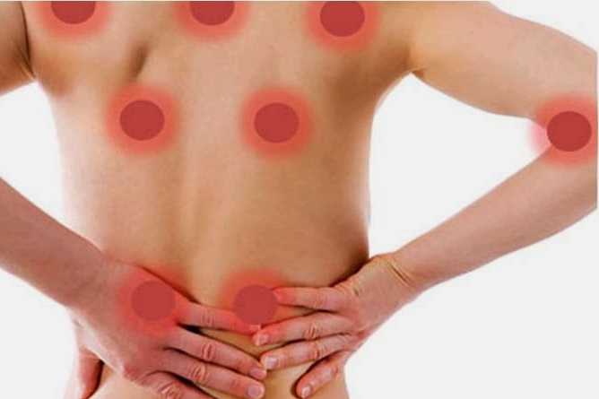 La fibromialgia 8