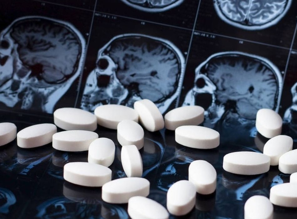 Enfermedades neurodegenerativas 2