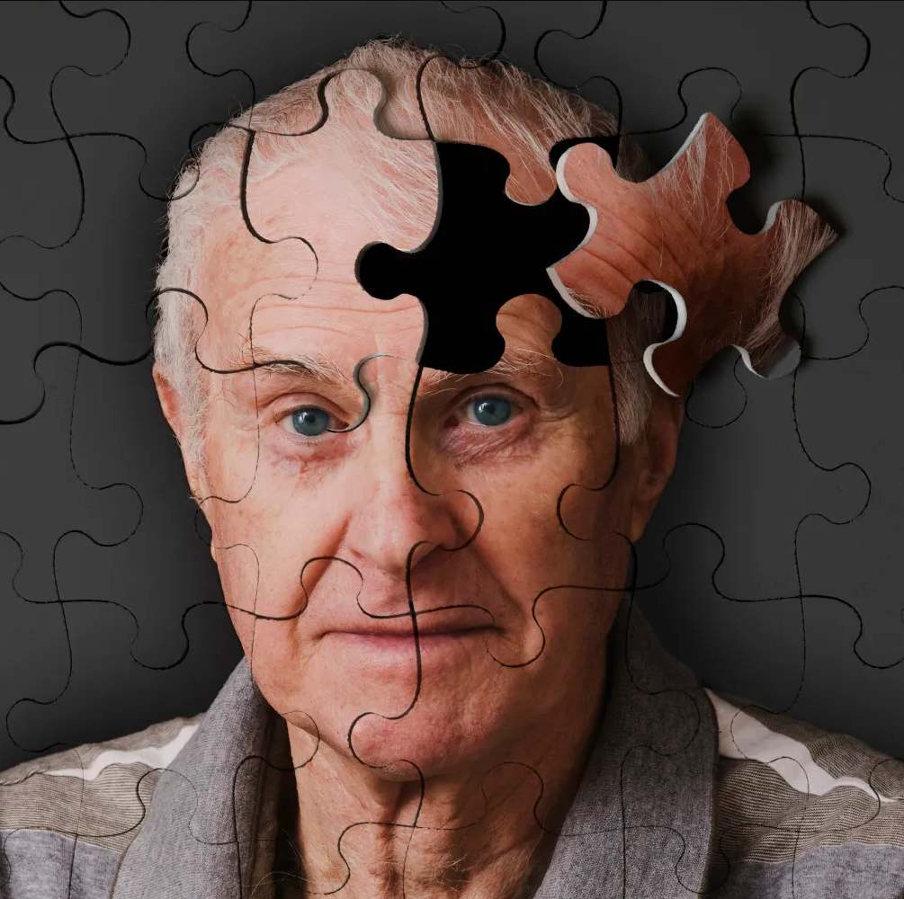 Enfermedades neurodegenerativas 9
